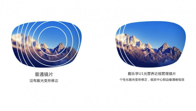 囿乐学U1光营养近视管理镜片让散光矫正更加合理